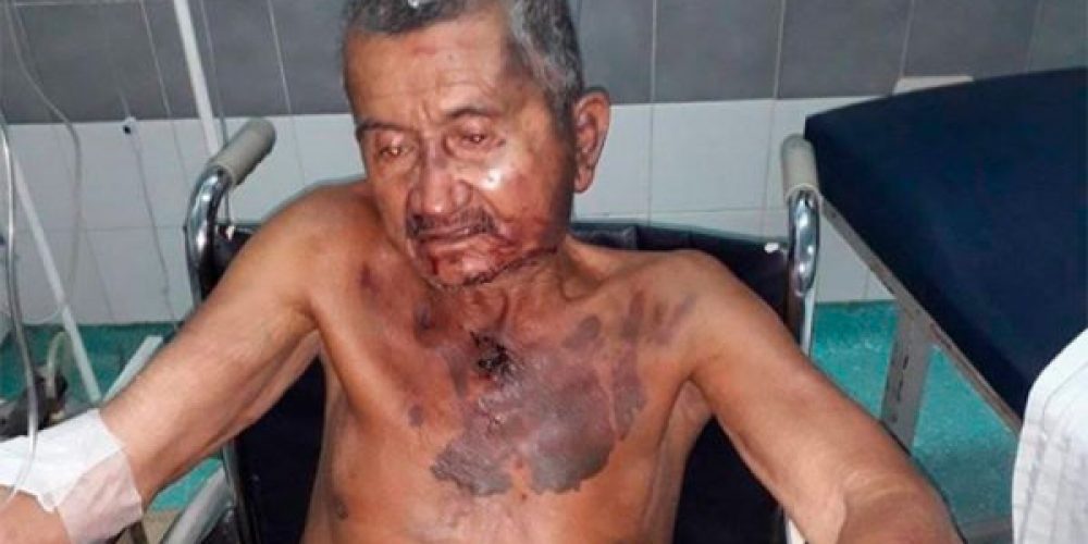 Golpean salvajemente a un hombre de 84 años para robarle dinero